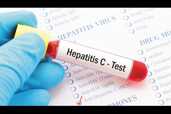 برنامه وزارت بهداشت برای حذف هپاتیت C در کشور