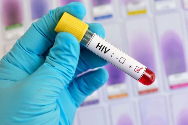  ۷۳ درصد مبتلایان HIV در گروه سنی ۲۰ تا ۴۵ سال