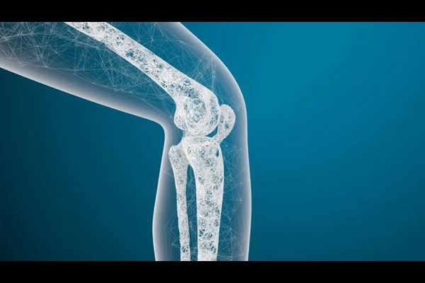 پوکی استخوان از دهه چهارم زندگی شروع می‌شود