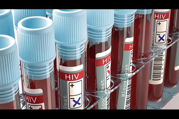 آخرین وضعیت HIV در کشور