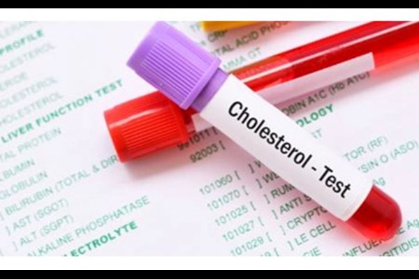 زنگ خطر افزایش کلسترول در جوانان 