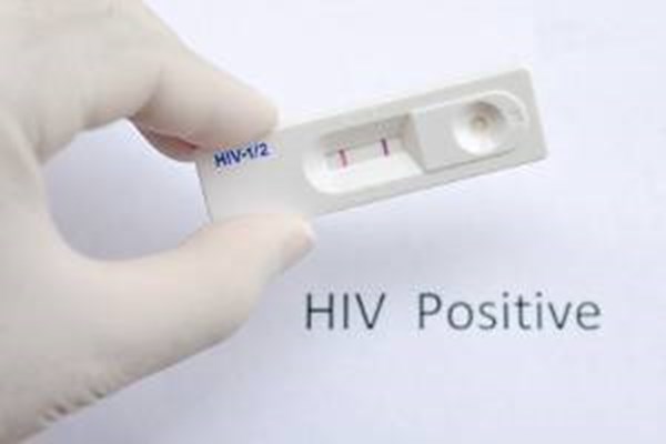  پایگاه‌های سلامت تست رایگان HIV می‌گیرند